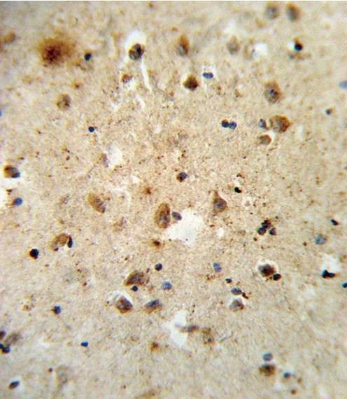 Anti-ATF6 (Center) Antibody