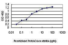 Anti-KSR2 Antibody