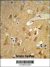 Anti-TSPAN12 (C-term) Antibody