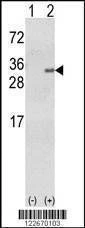 Anti-GSTA1 Antibody