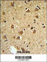 Anti-DIO2 (Center) Antibody