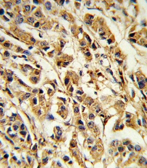 Anti-SREBF1 (Center) Antibody