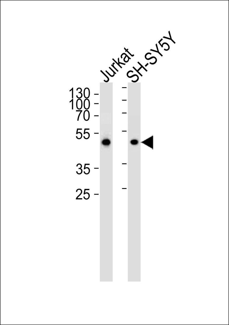 Anti-ANXA7 (Center) Antibody