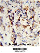 Anti-SKIV2L2 (Center) Antibody