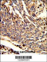Anti-ARPC1B (Center) Antibody