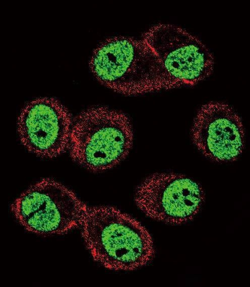 Anti-BMI1 Antibody