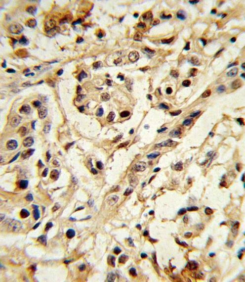 Anti-BMI1 Antibody