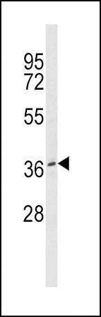Anti-BMI1 Antibody