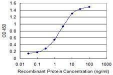 Anti-LALBA Antibody