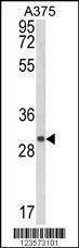 Anti-CTHRC1 (N-term) Antibody