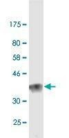 Anti-LAMA2 Antibody