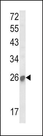 Anti-SOCS1 (N-term) Antibody