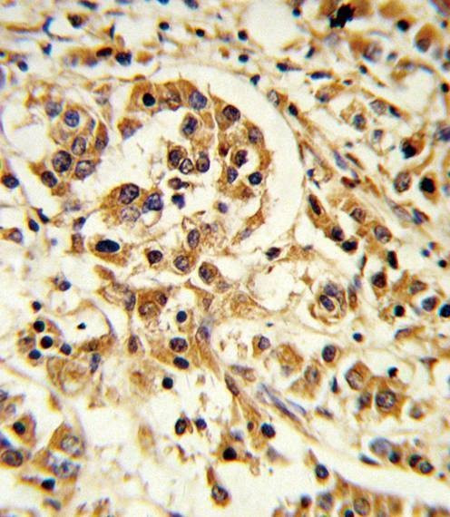 Anti-IL12A (C-term) Antibody