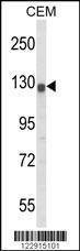 Anti-KCNH2 (Center) Antibody
