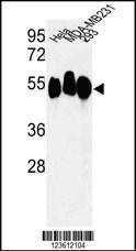 Anti-RBBP7 (N-term) Antibody