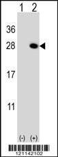 Anti-QDPR (C-term) Antibody
