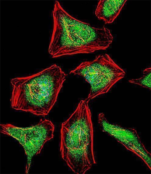 Anti-ATF7 (N-term) Antibody
