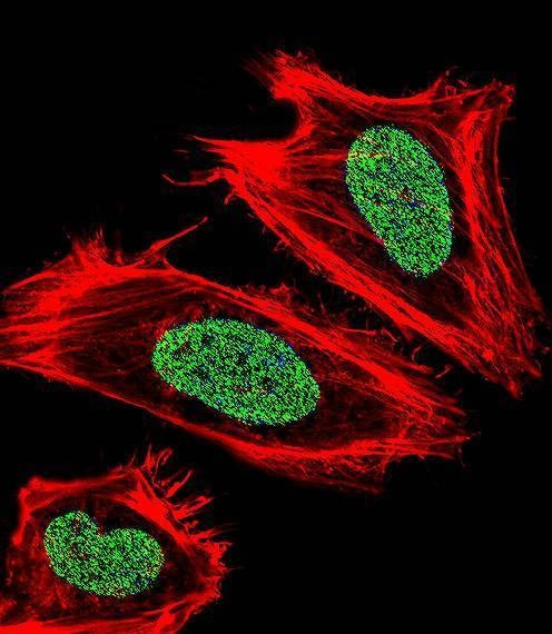 Anti-UHRF1 (Center) Antibody