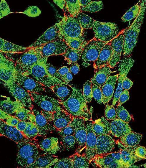 Anti-PSMB1 (C-term) Antibody
