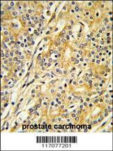 Anti-CYP51A1 (C-term) Antibody