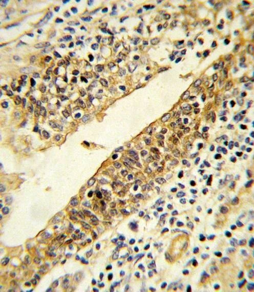 Anti-CYP51A1 (Center) Antibody