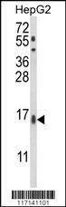 Anti-MGST2 (C-term) Antibody