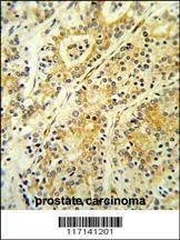 Anti-MGST2 (C-term) Antibody