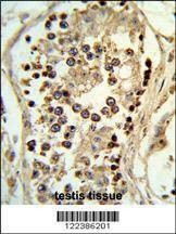 Anti-ABHD12 (N-term) Antibody