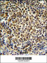 Anti-KIR2DL5B (Center) Antibody