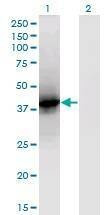 Anti-LCAT Antibody