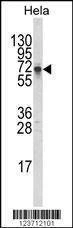 Anti-DTX1 (Center) Antibody