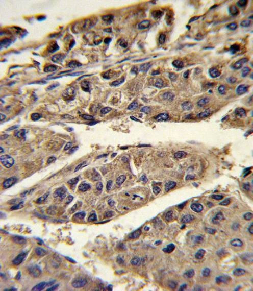 Anti-HP (Center) Antibody