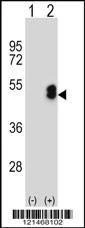 Anti-LMX1B (Center) Antibody