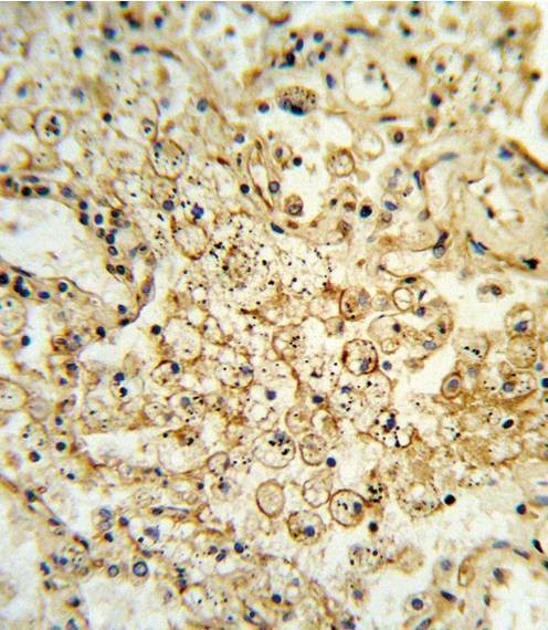 Anti-HLA-G (Center) Antibody