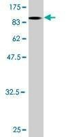 Anti-LCK Antibody