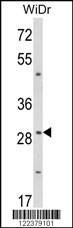 Anti-ZFP36 (Center) Antibody