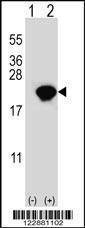 Anti-PIN1 (Center) Antibody