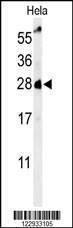 Anti-RAB8A Antibody