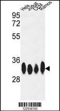 Anti-ELAVL1 Antibody