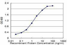 Anti-LDLR Antibody