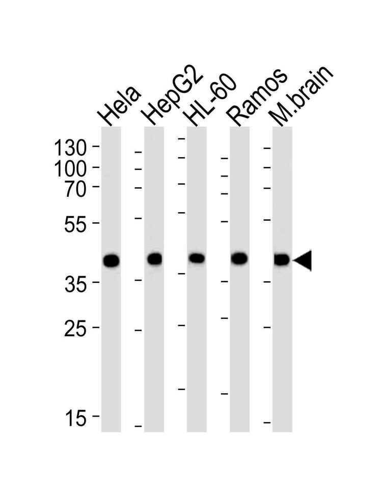 Anti-GOT2 (N-term) Antibody