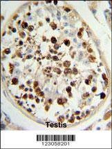 Anti-C13orf3 (Center) Antibody