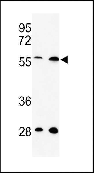 Anti-C13orf3 (Center) Antibody
