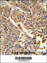 Anti-JUP (C-term) Antibody