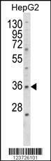 Anti-E2F5 (N-term) Antibody