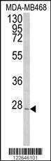 Anti-PEX11A (N-term) Antibody