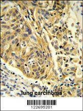 Anti-CLTA (Center) Antibody