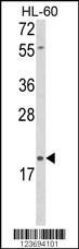 Anti-DLK2 (C-term) Antibody