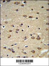 Anti-DLK2 (C-term) Antibody