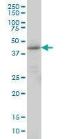 Anti-LEFTY1 Antibody